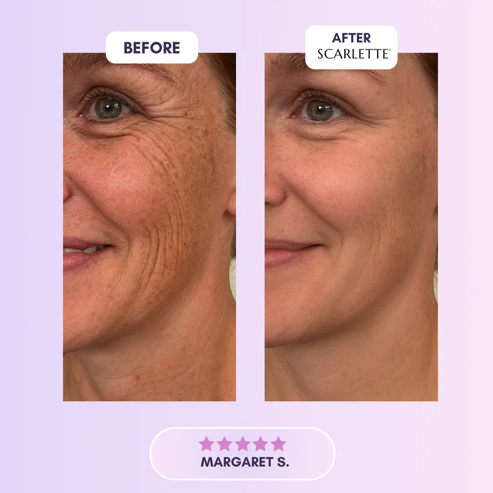 Scarlette™ Silicone Collagen Sheets