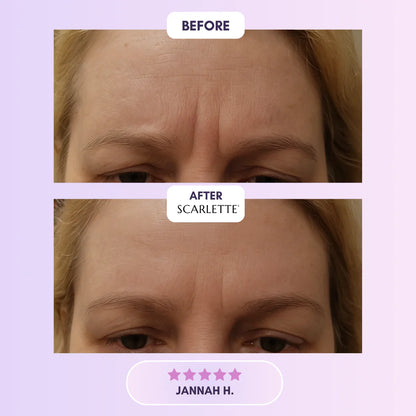 Scarlette™ Silicone Collagen Sheets