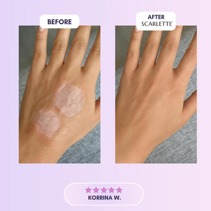Scarlette™ Silicone Collagen Sheets